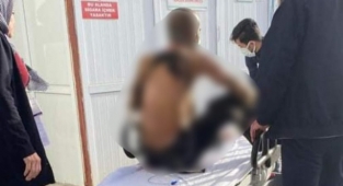 Üzerine benzin döküp kendini ateşe verdi
