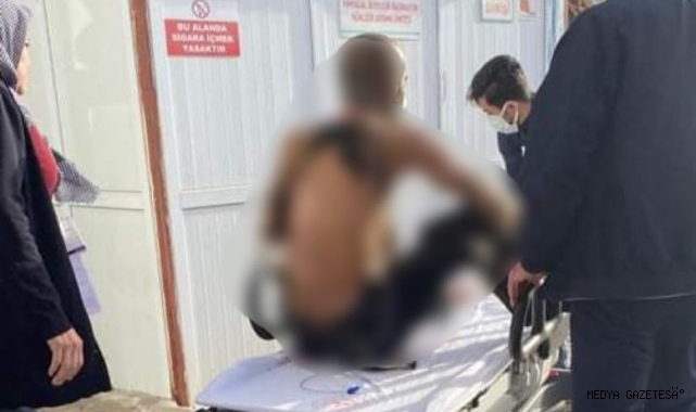 Üzerine benzin döküp kendini ateşe verdi