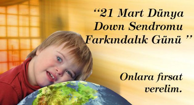 21 Mart tarihini resmi Dünya Down Sendromu Günü